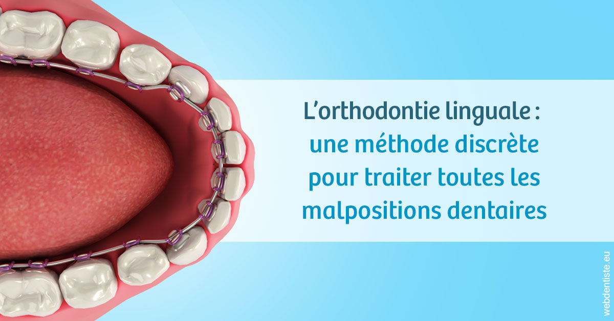 https://selarl-dentech.chirurgiens-dentistes.fr/L'orthodontie linguale 1