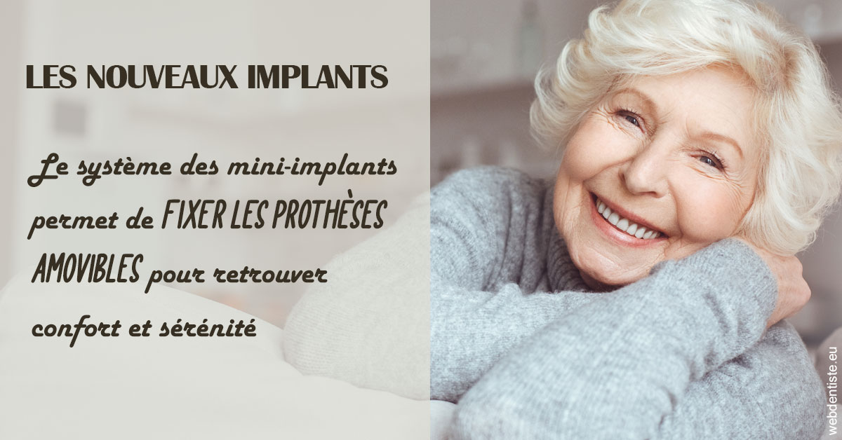 https://selarl-dentech.chirurgiens-dentistes.fr/Les nouveaux implants 1