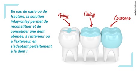https://selarl-dentech.chirurgiens-dentistes.fr/L'INLAY ou l'ONLAY