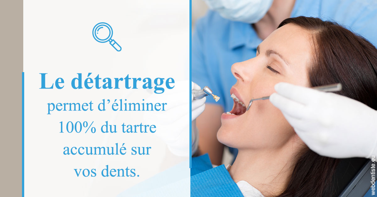 https://selarl-dentech.chirurgiens-dentistes.fr/En quoi consiste le détartrage