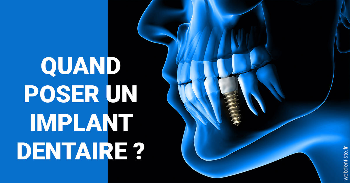https://selarl-dentech.chirurgiens-dentistes.fr/Les implants 1