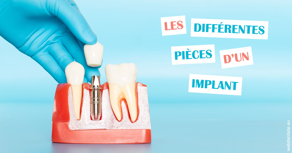 https://selarl-dentech.chirurgiens-dentistes.fr/Les différentes pièces d’un implant 2