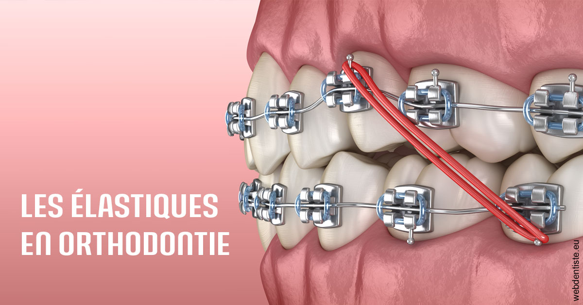 https://selarl-dentech.chirurgiens-dentistes.fr/Elastiques orthodontie 2