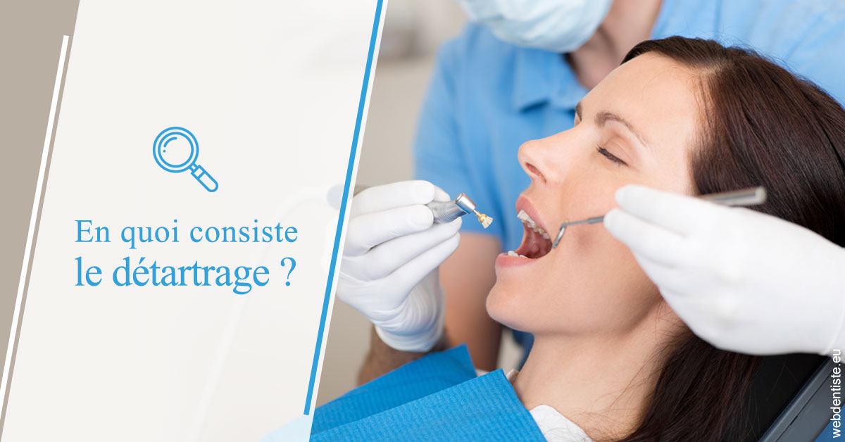 https://selarl-dentech.chirurgiens-dentistes.fr/En quoi consiste le détartrage