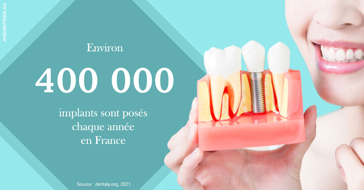 https://selarl-dentech.chirurgiens-dentistes.fr/Pose d'implants en France 2